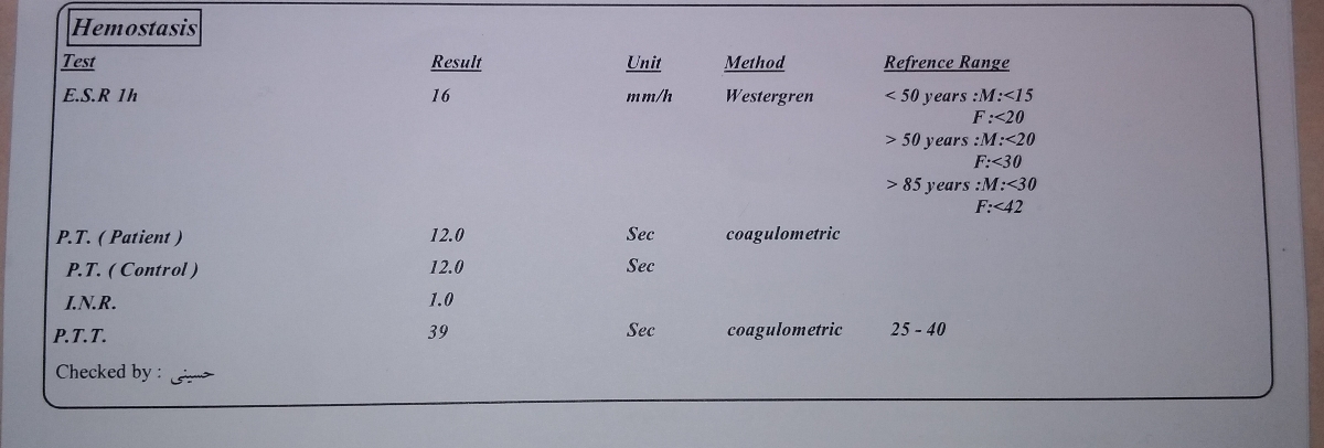 خستگی و کسلی و کم انرژی بودن خستگی و کسلی و کم انرژی بودن