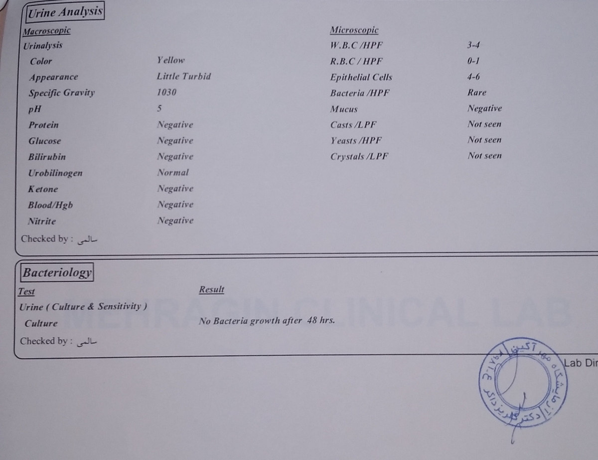 خستگی و کسلی و کم انرژی بودن خستگی و کسلی و کم انرژی بودن