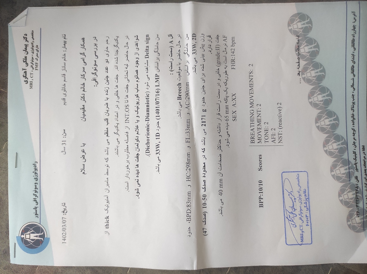 سونوی وزن و تعیین زمان زایمان دوقلویی سونوی وزن و تعیین زمان زایمان دوقلویی