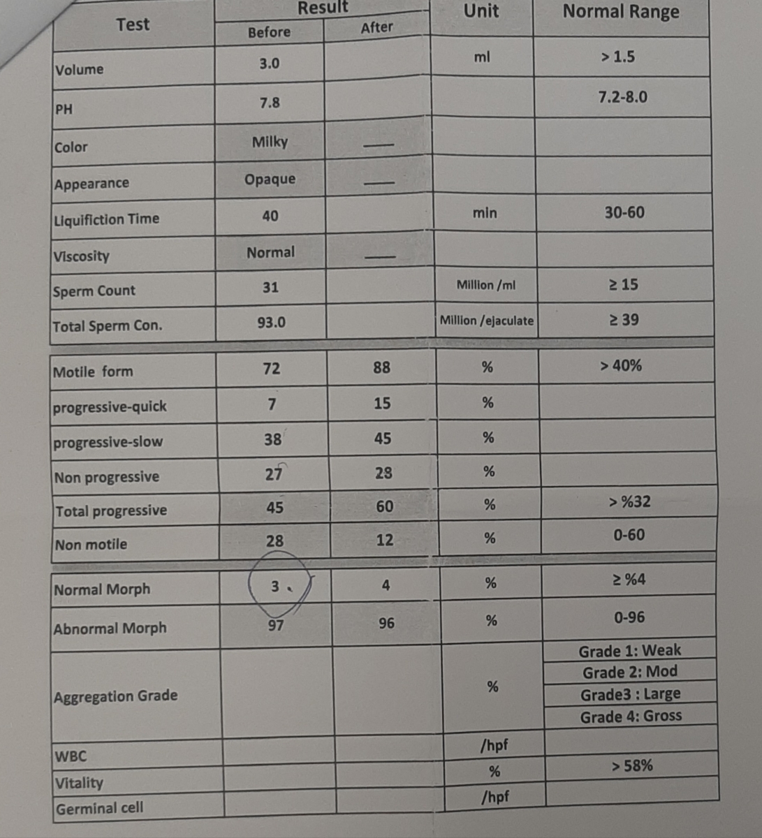 بررسی نتیجه آزمایش اسپرم