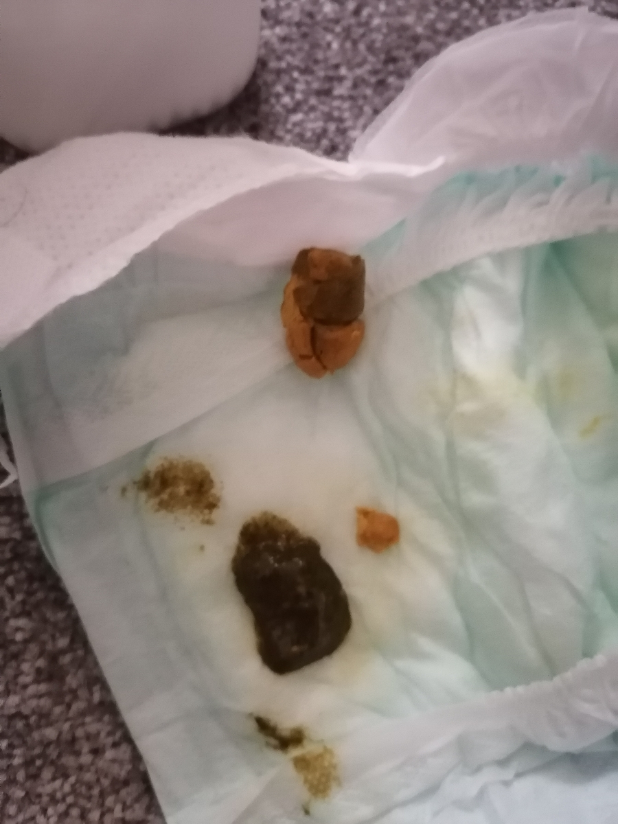 مدفوع سبز رنگ و مدفوع خشک و سفت