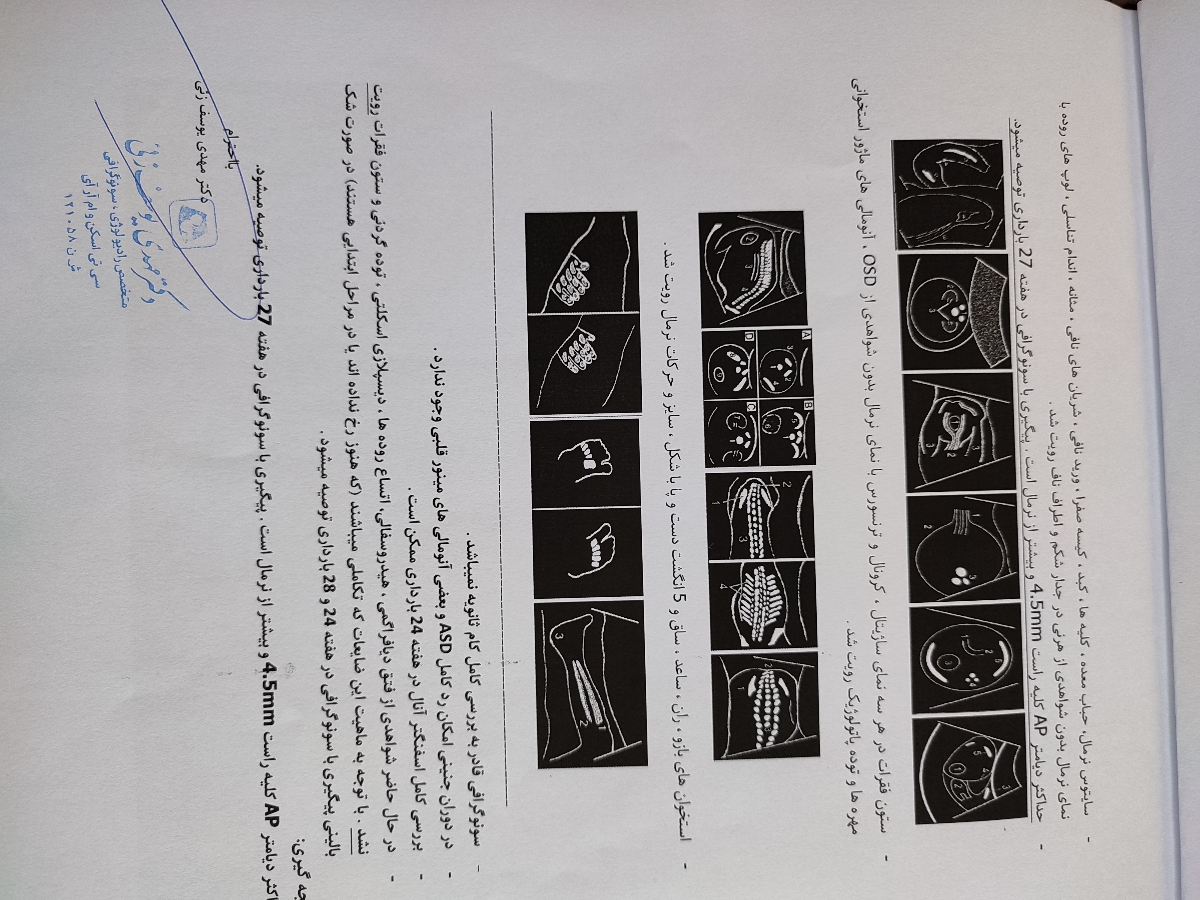 تفسیر سونوی غربالگری دوم