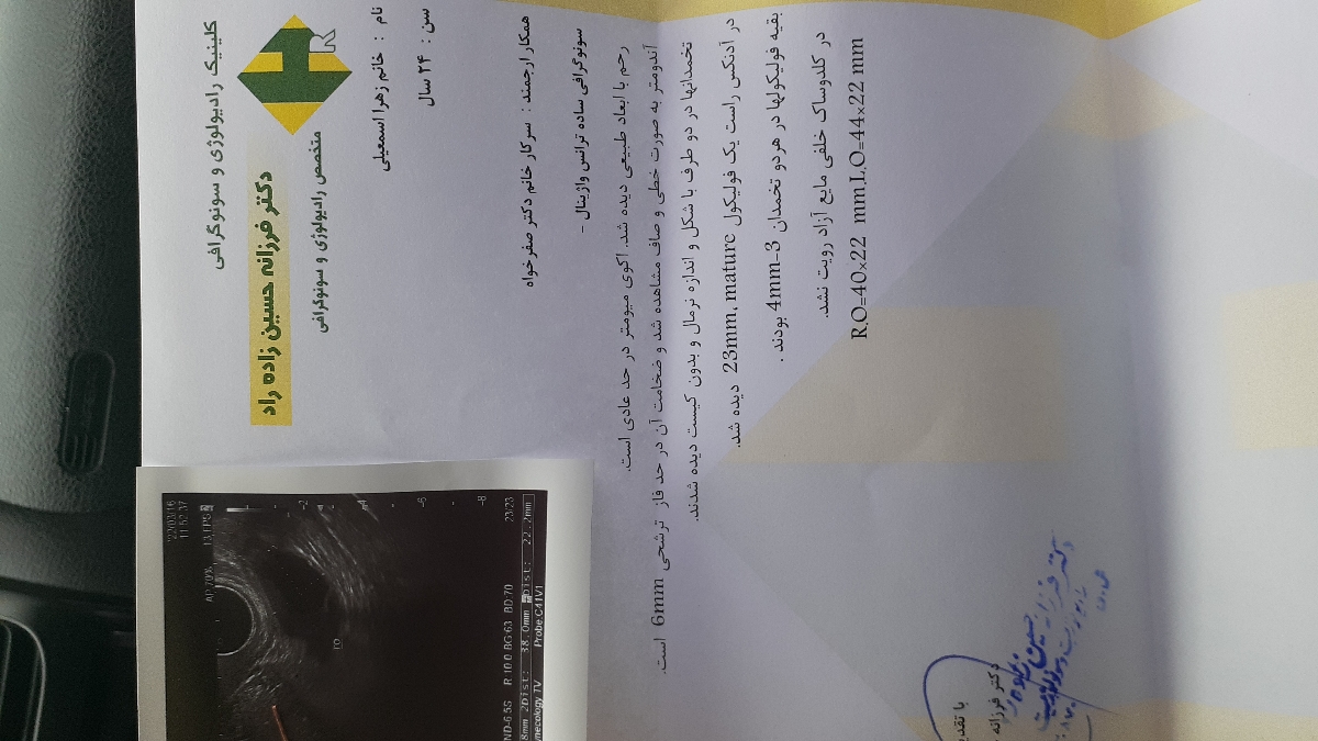 سونوگرافی واژینال تنبلی تخمدان