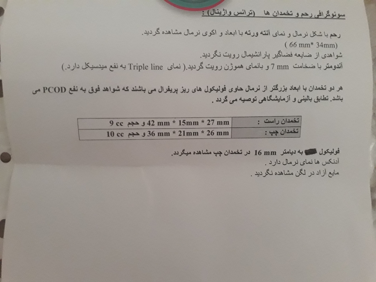 سونوگرافی تخمک گذاری سونو