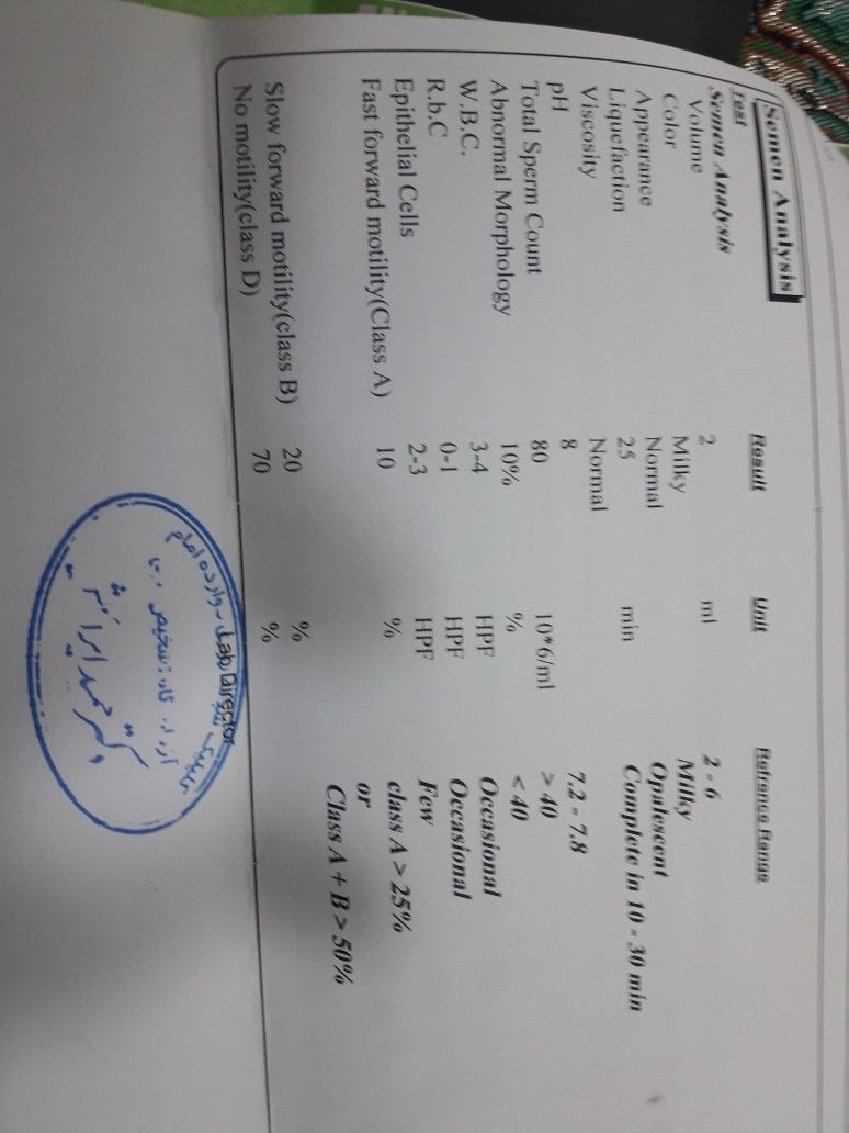 درد و کیست تخمدان چپ در زمان پریودی درد و کیست تخمدان چپ در زمان پریودی