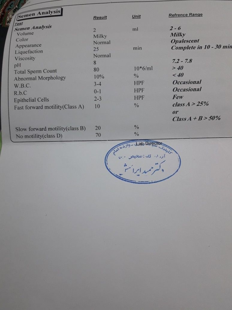 درد و کیست تخمدان چپ در زمان پریودی درد و کیست تخمدان چپ در زمان پریودی