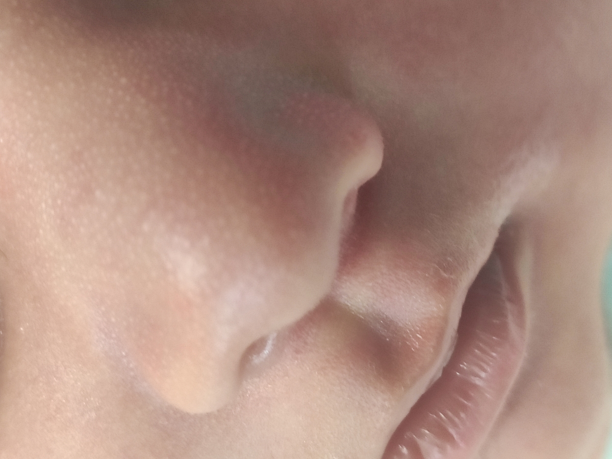 رفلاکس پنهان شدید لطفا کمک کنید تجربیاتتون را بگید دارم اذیت میشم رفلاکس پنهان شدید لطفا کمک کنید تجربیاتتون را بگید دارم اذیت میشم