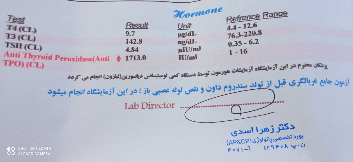 جواب آزمایش تیروئید و آنتی tpo