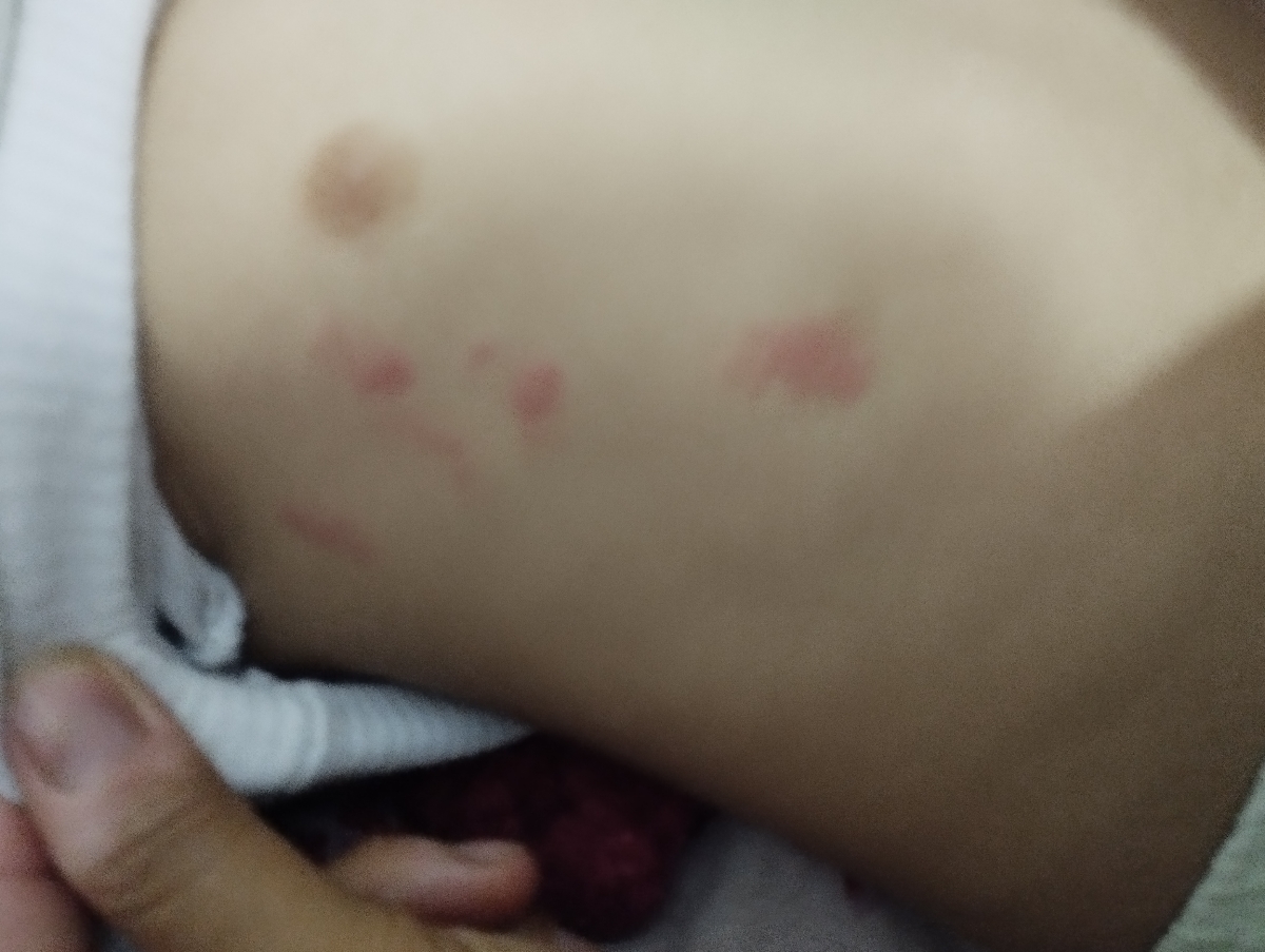 دلیل به وجود امدن این زخما دلیل به وجود امدن این زخما