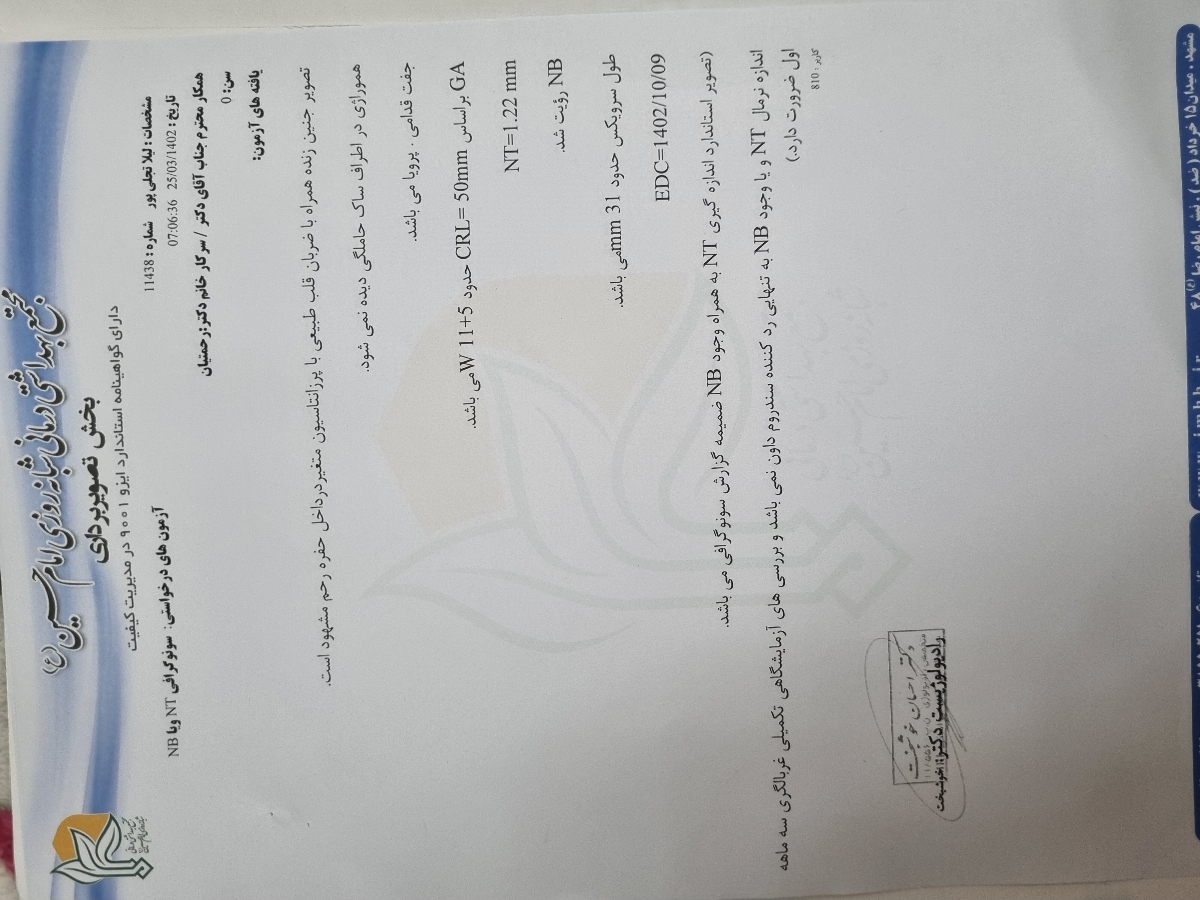 خونریزی در هفته ۱۲ بارداری خونریزی در هفته ۱۲ بارداری