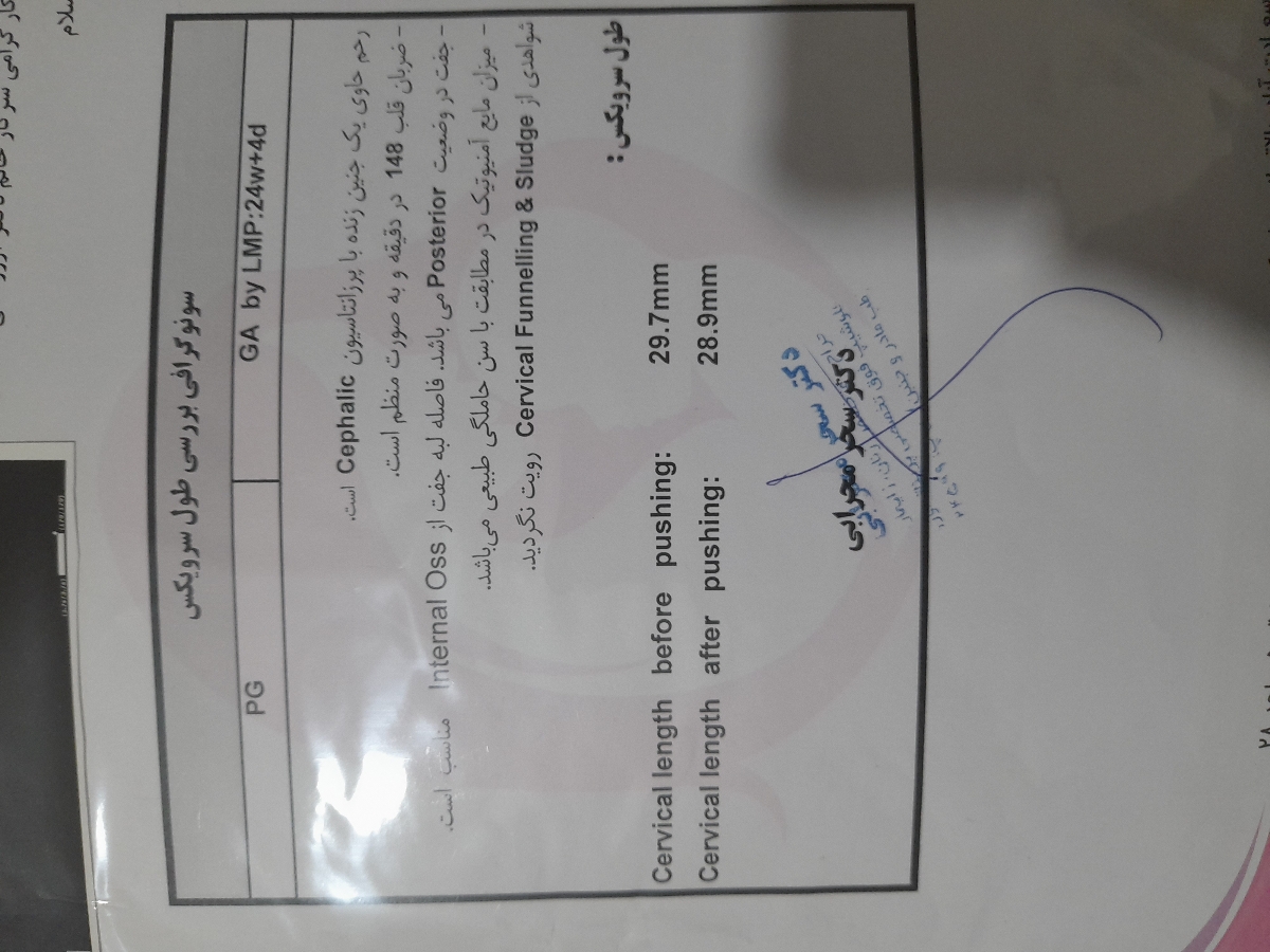لکه بینی در ماه هفتم