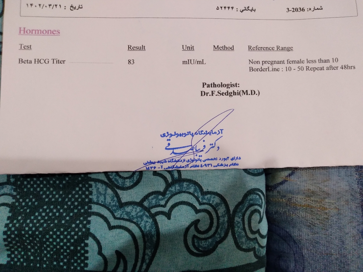 بی بی چکمو ببینید .... بی بی چکمو ببینید ....