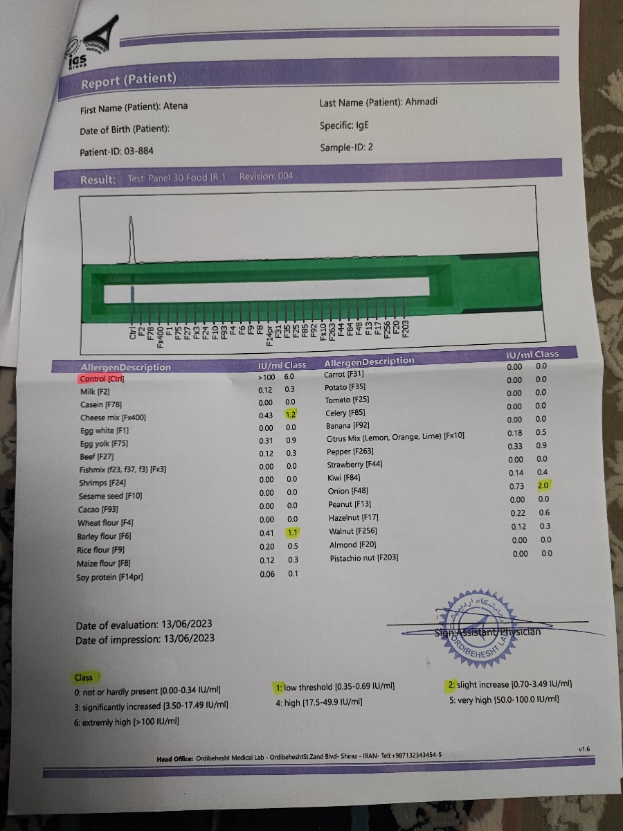 آزمایش آلرژی خون ‌کودک