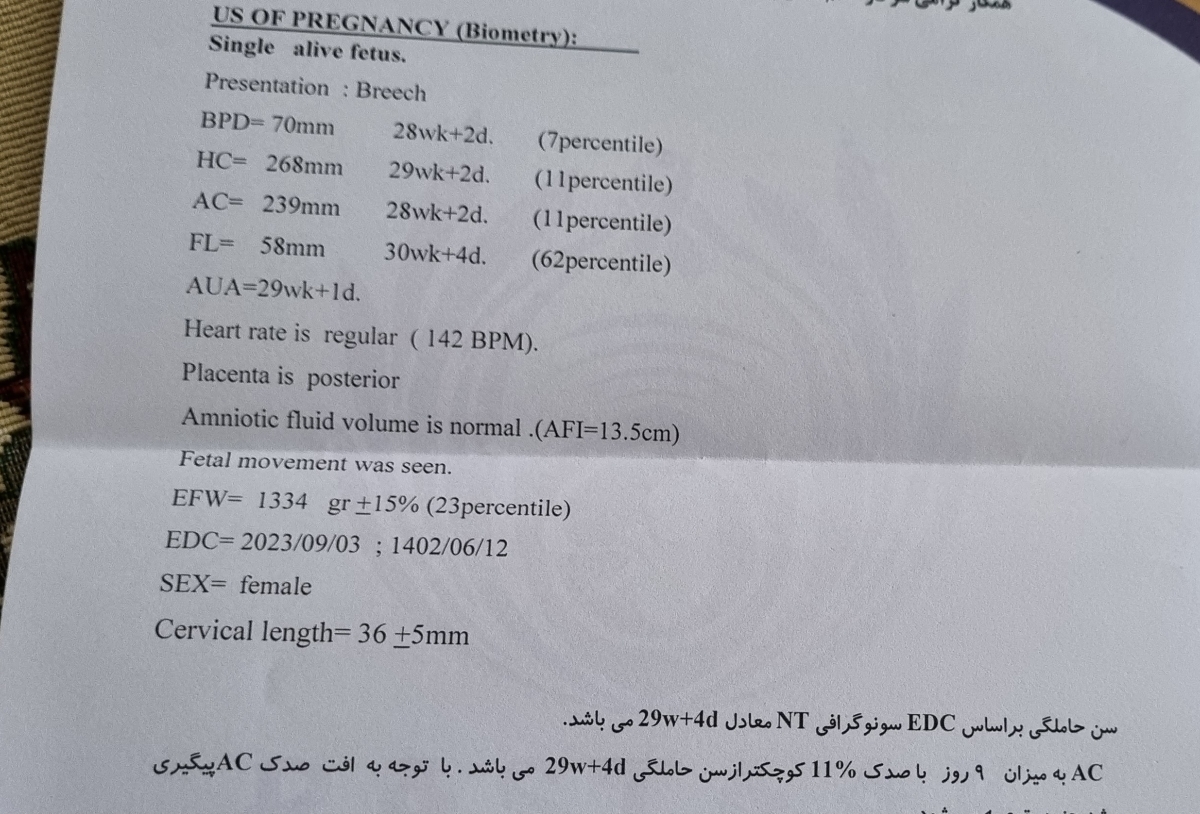 سونو وزن ۳۰ هفتگی سونو وزن ۳۰ هفتگی