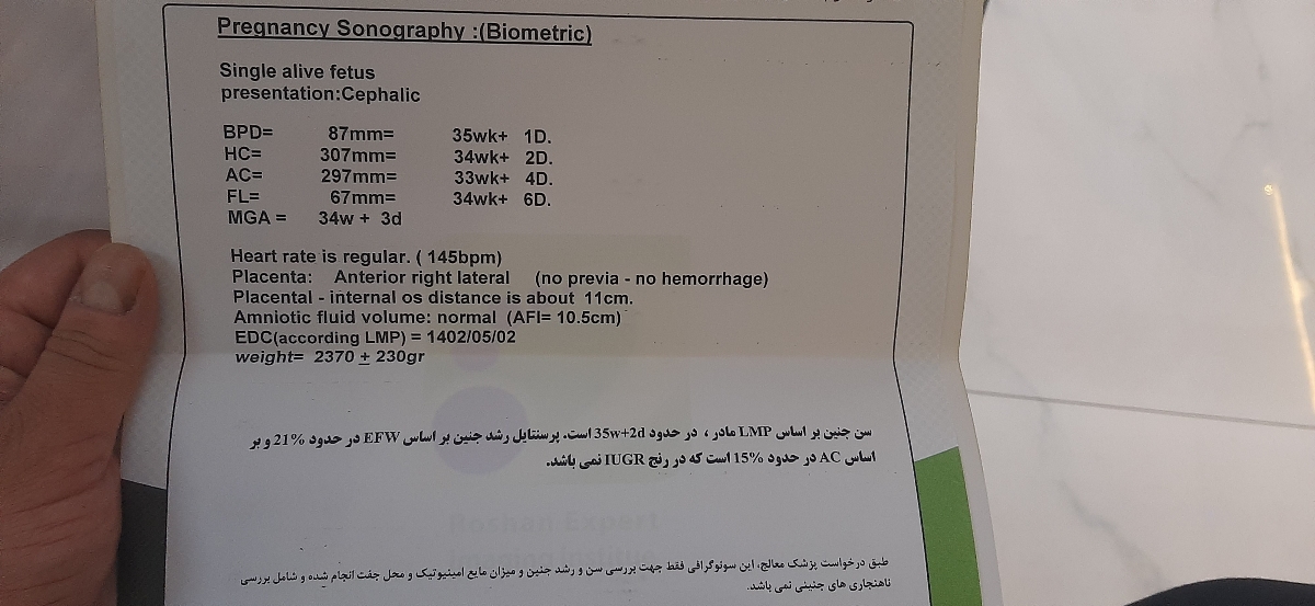 تفسیر سونو ۳۶ هفته تفسیر سونو ۳۶ هفته