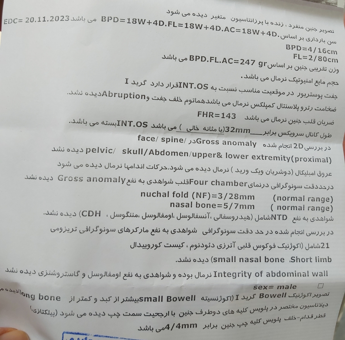 تفسیر سونو انومالی بارداری تفسیر سونو انومالی بارداری