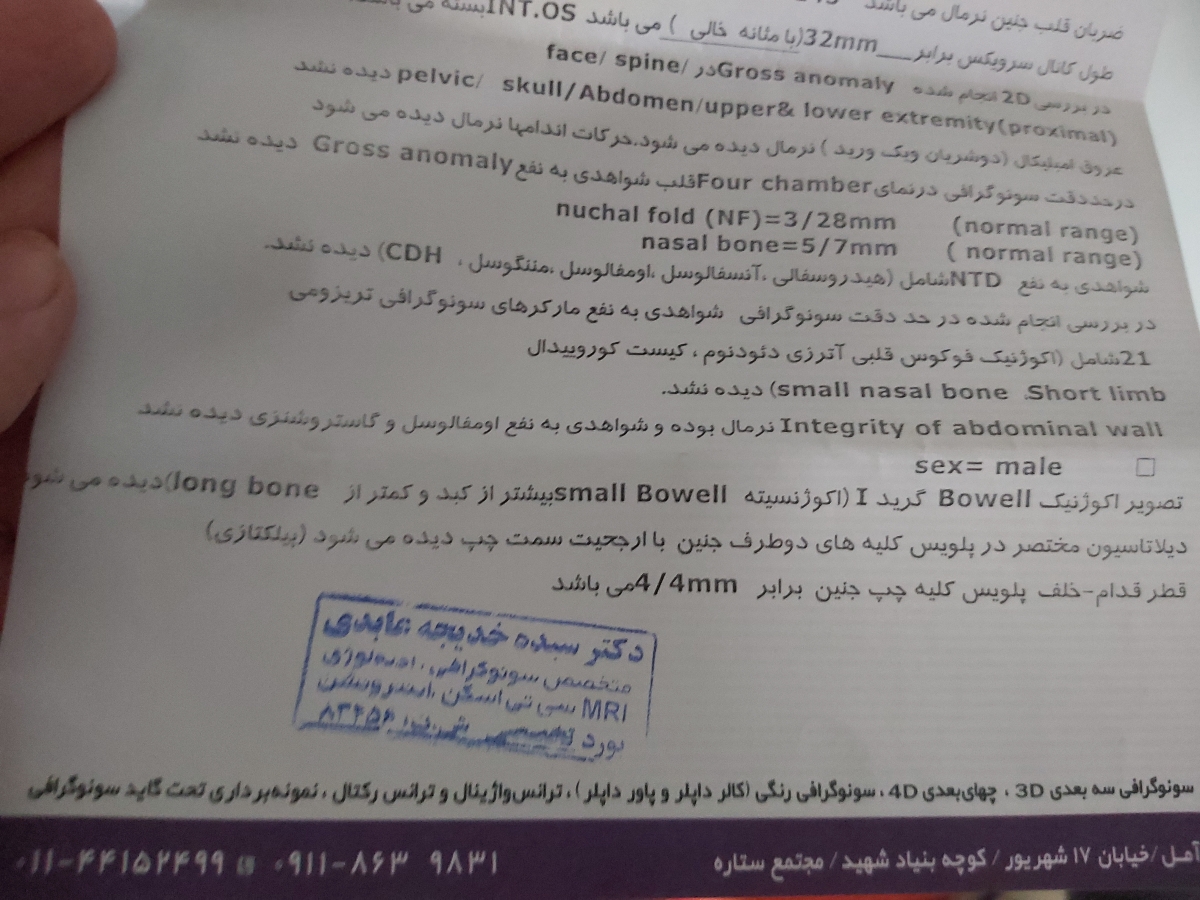 تفسیر سونو انومالی بارداری تفسیر سونو انومالی بارداری