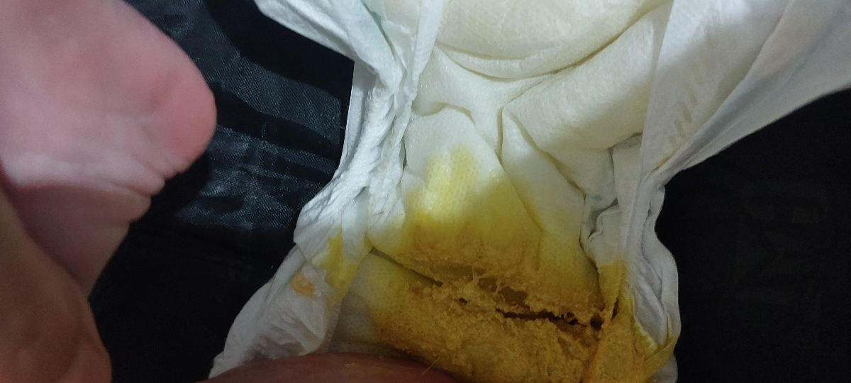 خوردن شیر مادر و شیر خشک باعث اسهال میشه خوردن شیر مادر و شیر خشک باعث اسهال میشه