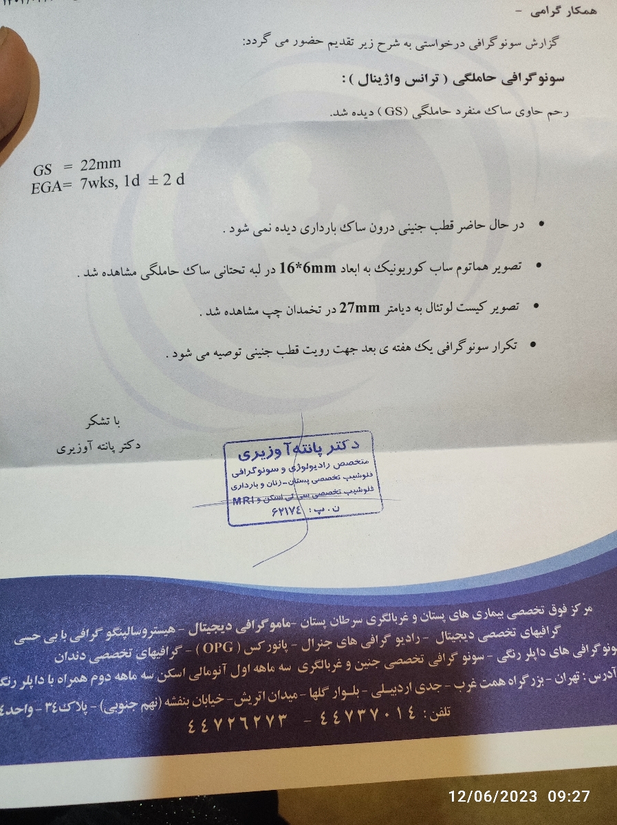 سلام عدم رویت فتال پل در هفته پنجم سلام عدم رویت فتال پل در هفته پنجم