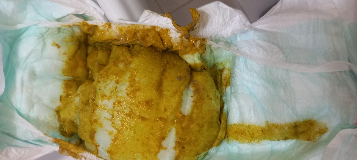 عکس مدفوع نوزاد