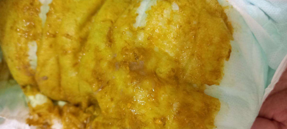 عکس مدفوع نوزاد
