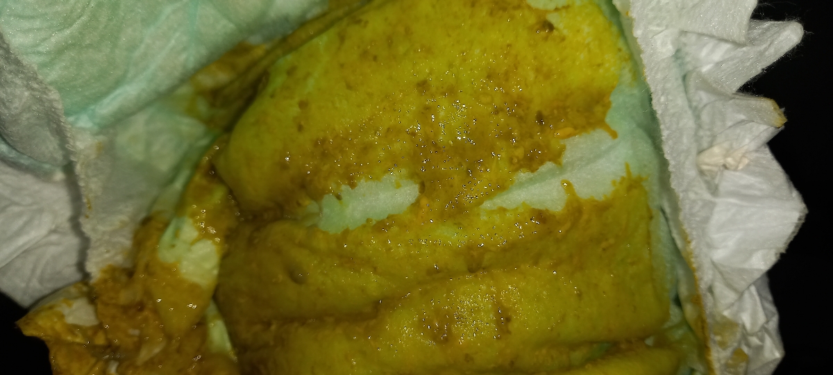 عکس مدفوع نوزاد