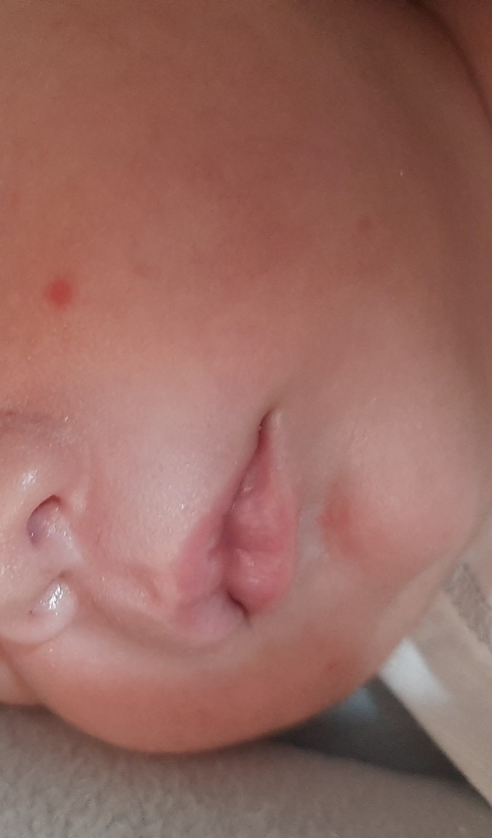 دونه قرمزازدیروزاولین بارروی گونه یدونه