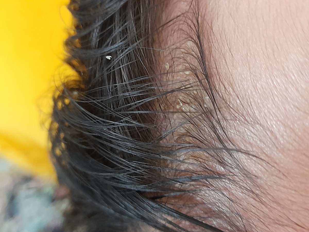 شوره کردن سر نوزاد😐 شوره کردن سر نوزاد😐