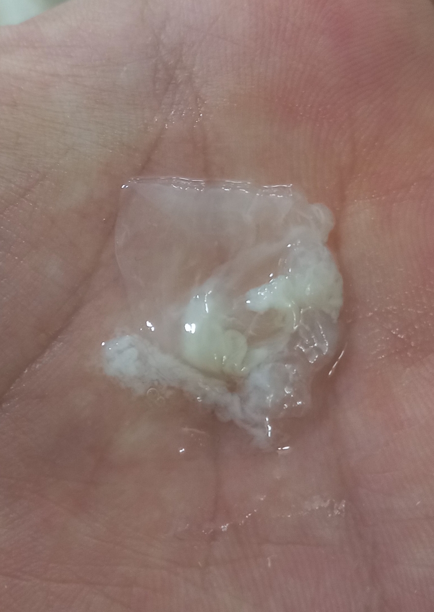 ترشحات در هفته ۱۶ بارداری + عکس ترشحات در هفته ۱۶ بارداری + عکس