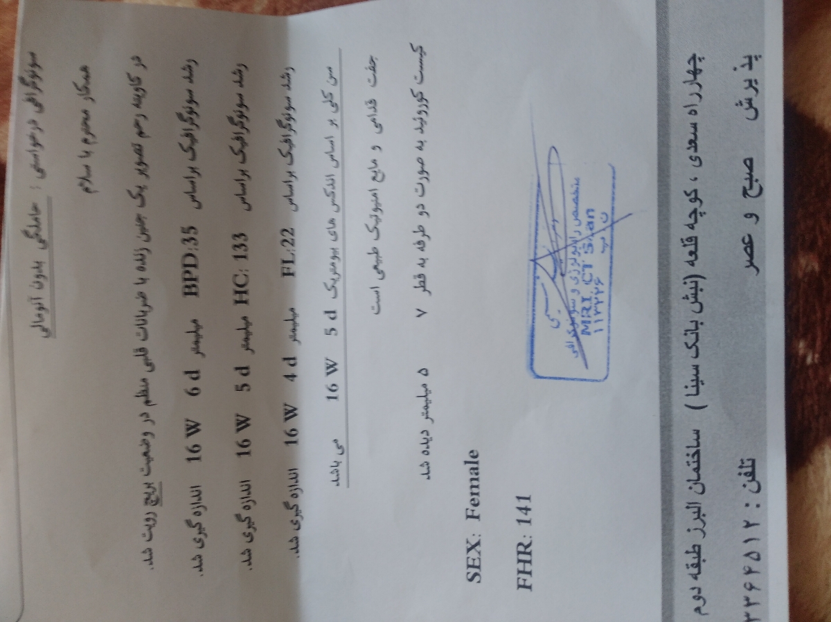 سونو ۱۸ هفته و کیست درسر جنین سونو ۱۸ هفته و کیست درسر جنین