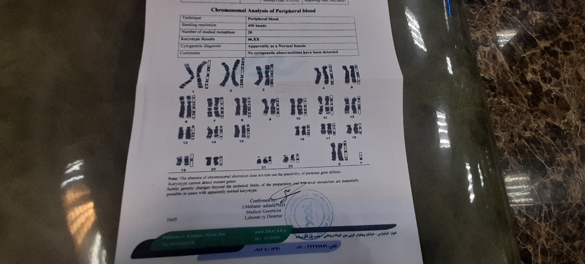 بررسی آزمایش کاریوتایپ بررسی آزمایش کاریوتایپ