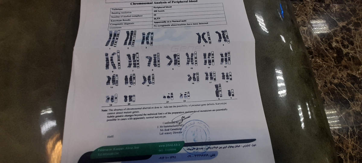 بررسی آزمایش کاریوتایپ بررسی آزمایش کاریوتایپ