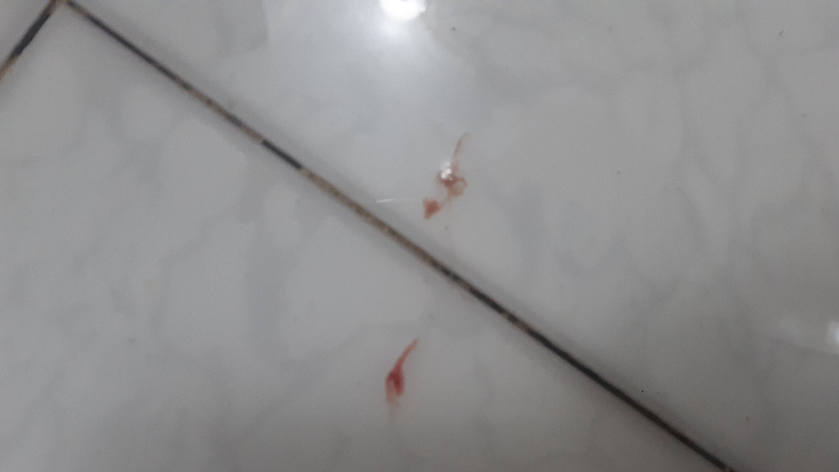 دوستان و دکتر جان زودی بیاین ببینین این لک بینی ها برای چیه دوستان و دکتر جان زودی بیاین ببینین این لک بینی ها برای چیه