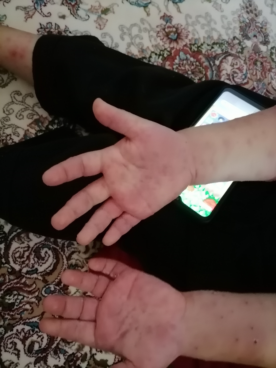 ابله مرغان بچه و مادر باردار ابله مرغان بچه و مادر باردار