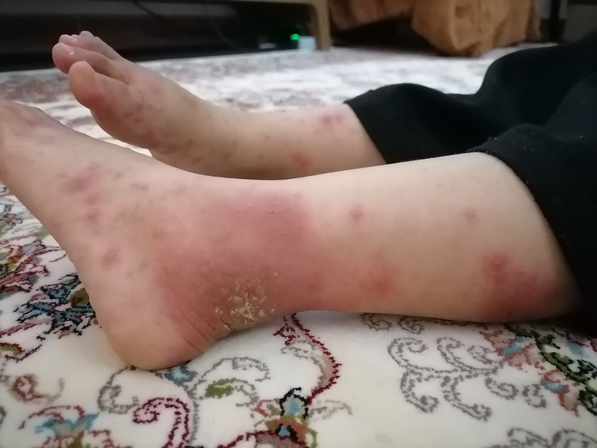 ابله مرغان بچه و مادر باردار ابله مرغان بچه و مادر باردار