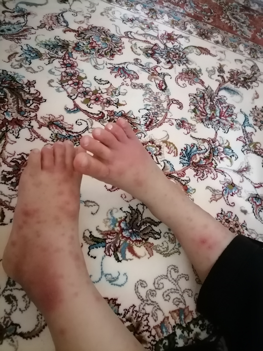 ابله مرغان بچه و مادر باردار ابله مرغان بچه و مادر باردار