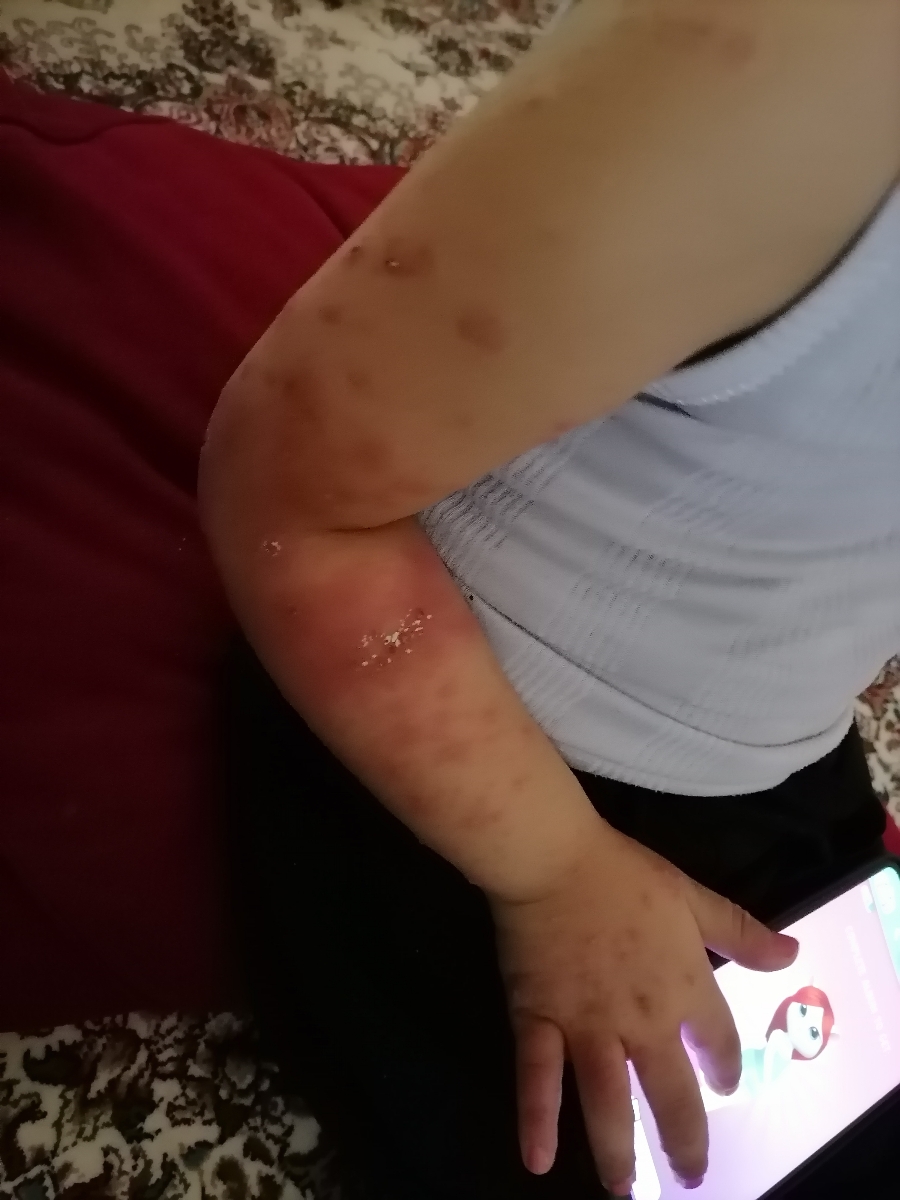 ابله مرغان بچه و مادر باردار ابله مرغان بچه و مادر باردار