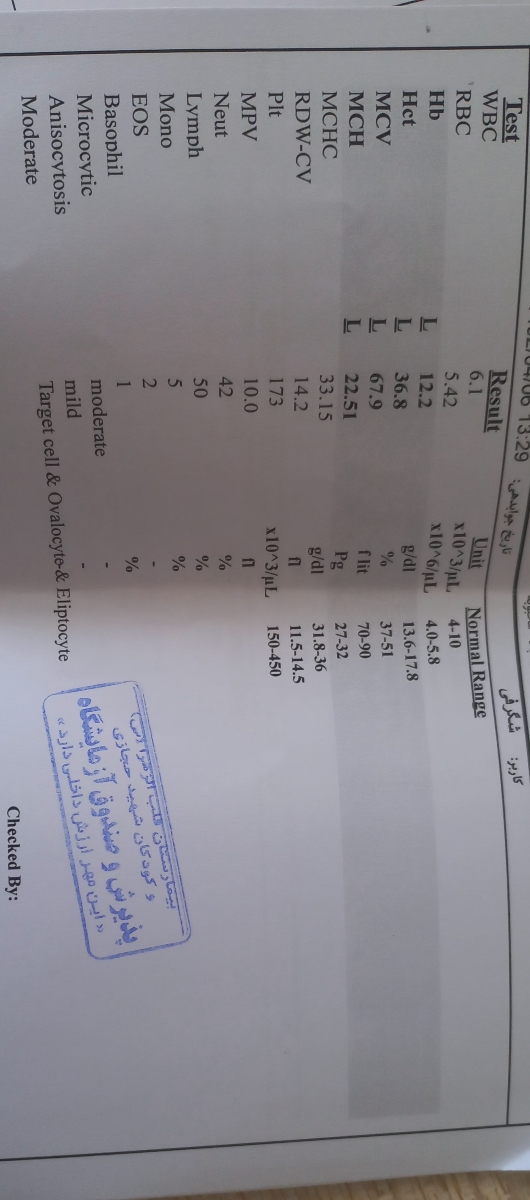 تفسیر آزمایش پسر ده ساله تفسیر آزمایش پسر ده ساله