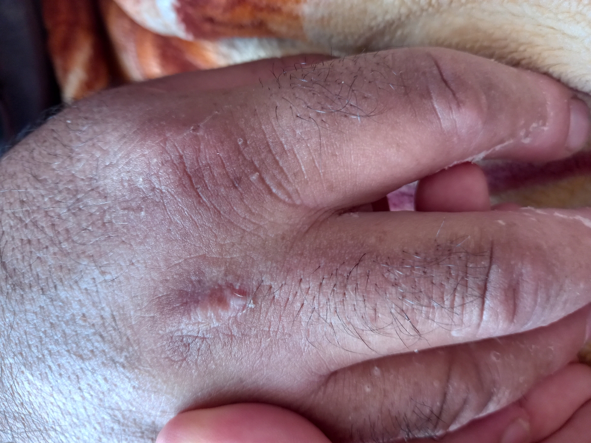 سلام دکتر جان دست همسرم یمدته پوست پوست میشه