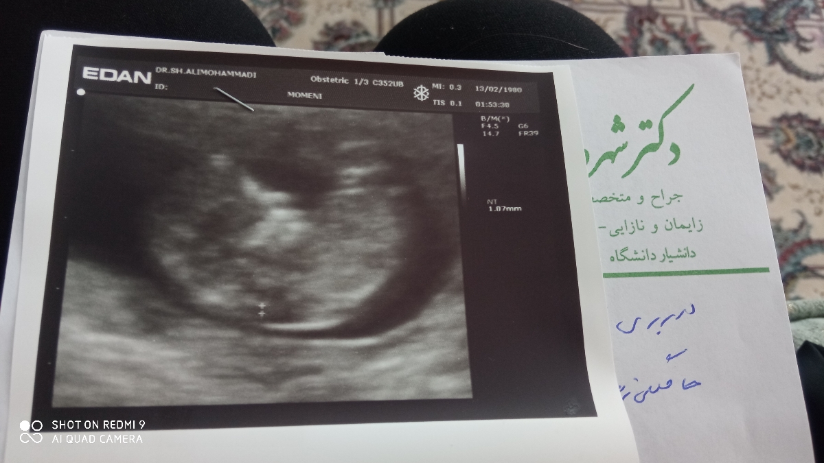 عکس سونو nt و جنسیت عکس سونو nt و جنسیت