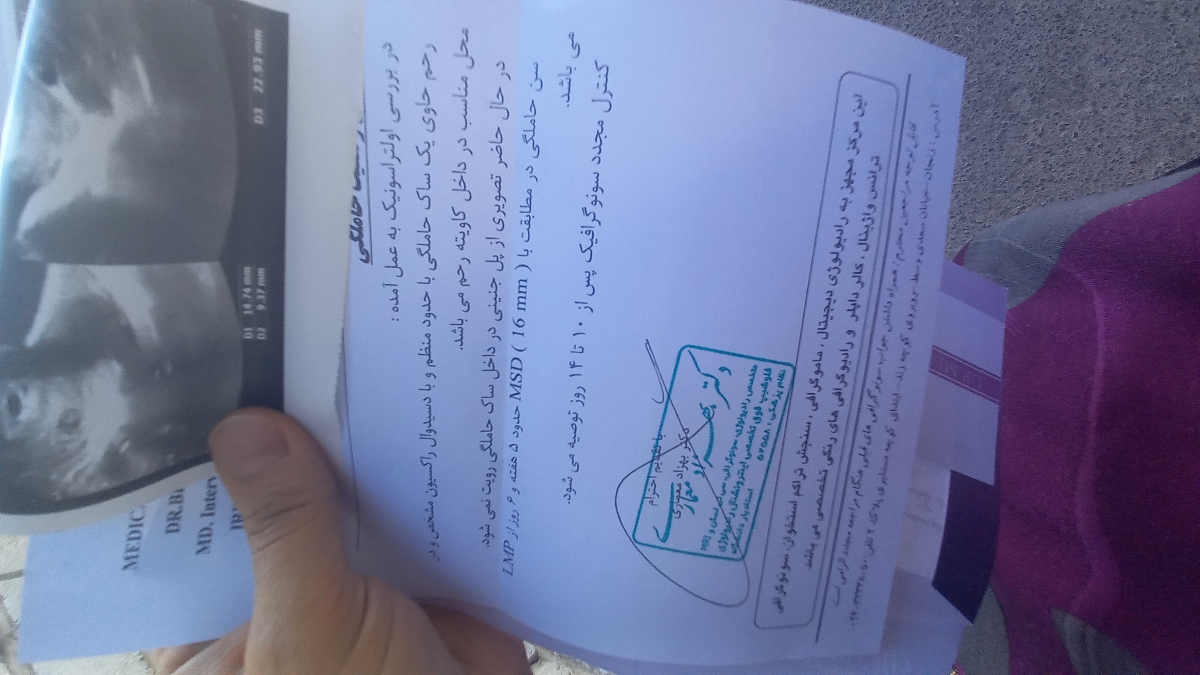 سونو تشکیل قلب و ندیدن پل جنینی سونو تشکیل قلب و ندیدن پل جنینی