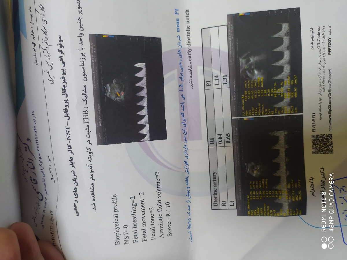 دکتر جان لطفا سونو رو اورژانسی تفسیر کنید دکتر جان لطفا سونو رو اورژانسی تفسیر کنید