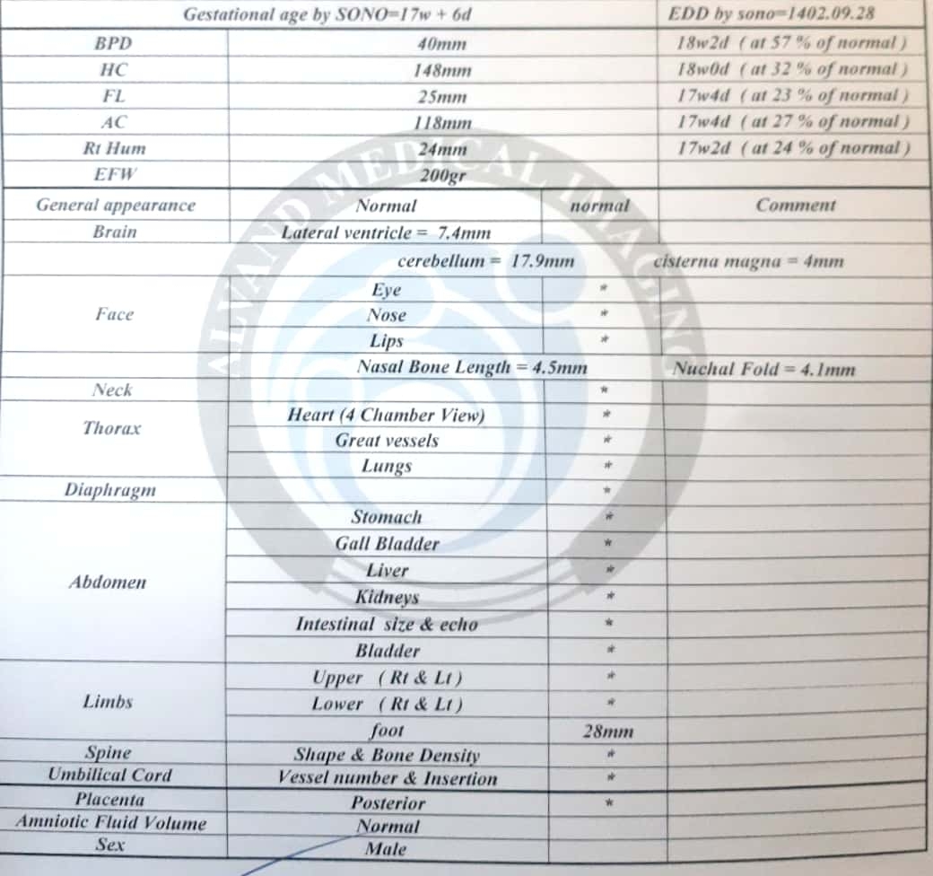 انومالی داپلر و اکو قلب جنین انومالی داپلر و اکو قلب جنین