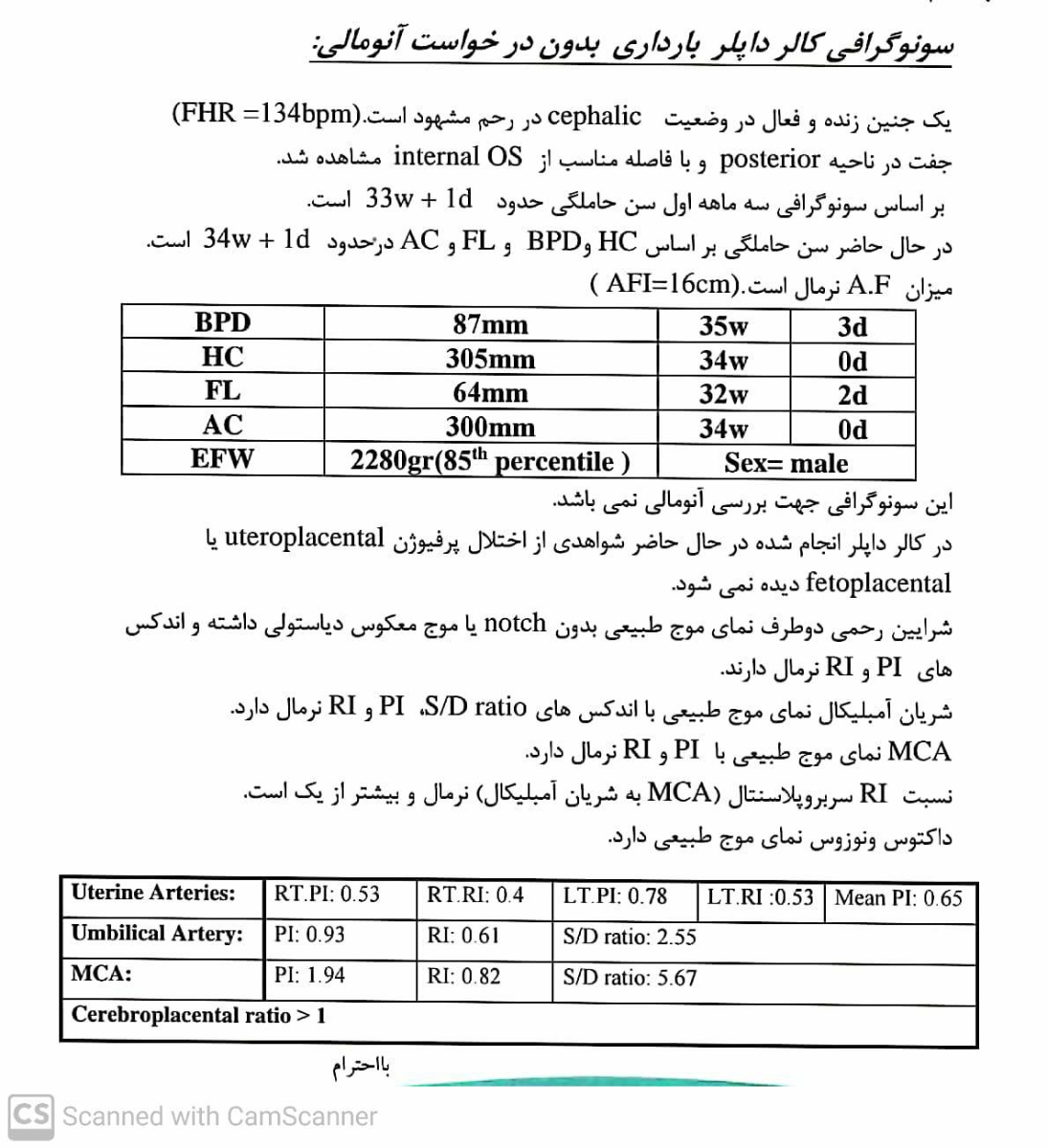 تفسیرسونو در هفته ۳۳
