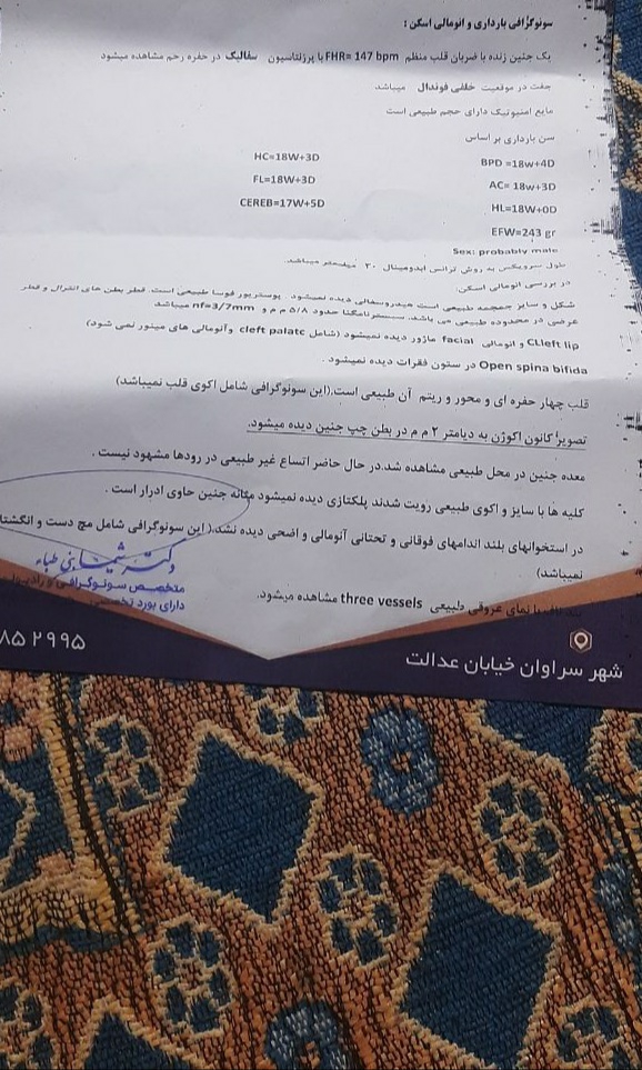 تفسیر سنو انومالی تفسیر سنو انومالی