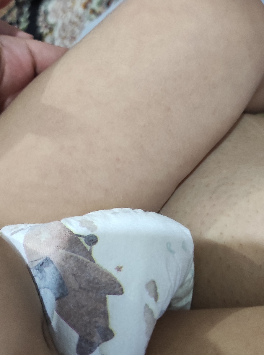 سلام خانما بدن پسرم هر از چند مدتی اینجوری میشه دلیلش چیه برای کسی پیش نیومده ؟؟