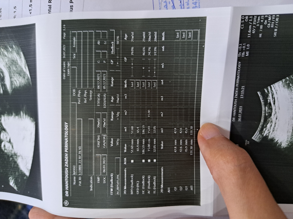 کسی مولتی ویتامینو قطع کرده