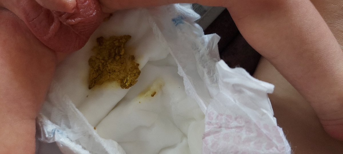 مدفوع نوزاد ۳ روزه +عکس مدفوع نوزاد ۳ روزه +عکس