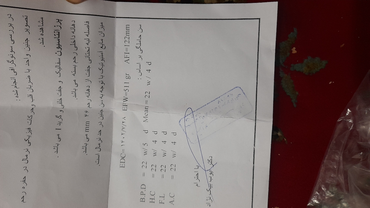لکه بینی درهفته 28بارداری و شکم روی ایا خطر داره لکه بینی درهفته 28بارداری و شکم روی ایا خطر داره