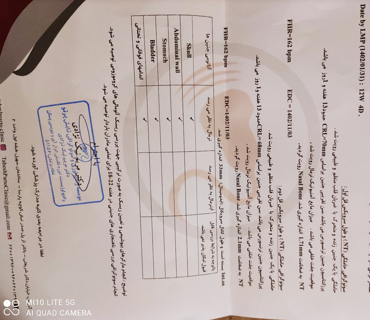 تفسیر سونو ان تی